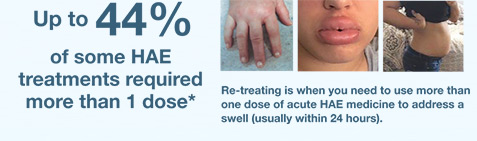 44% of patients experiencing HAE attacks have to retreat in order to get relief.